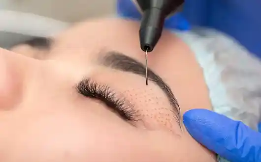 Eyelid Surgery